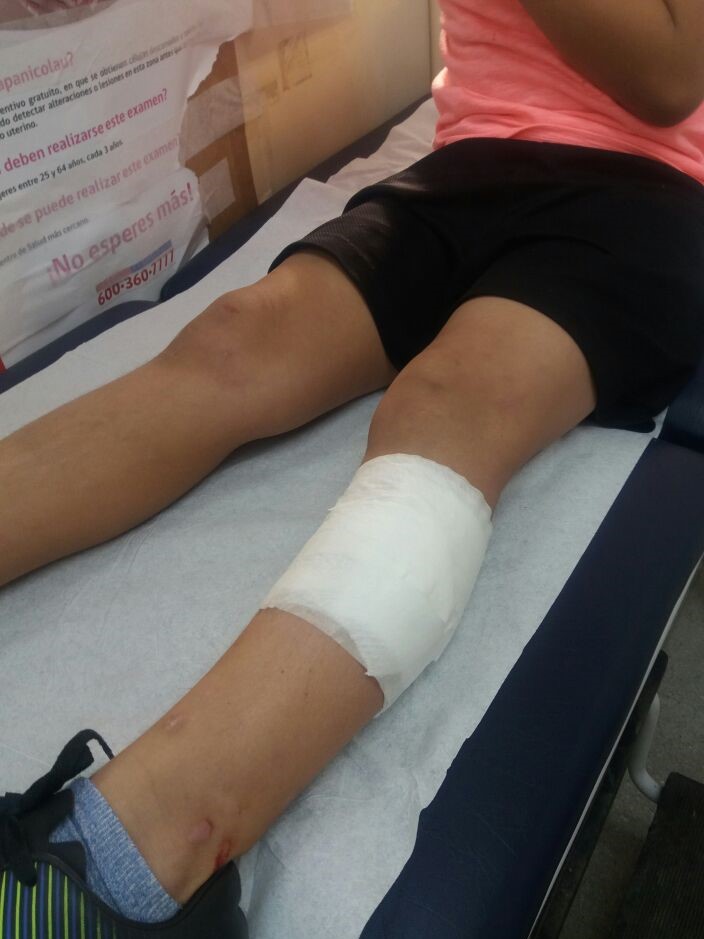 Menor de 7 años es atacado por jauría en la Plaza de Los Niños