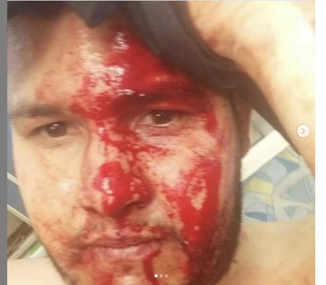 Rancagua: denuncian brutal agresión en contra de pareja venezolana en conocido centro comercial